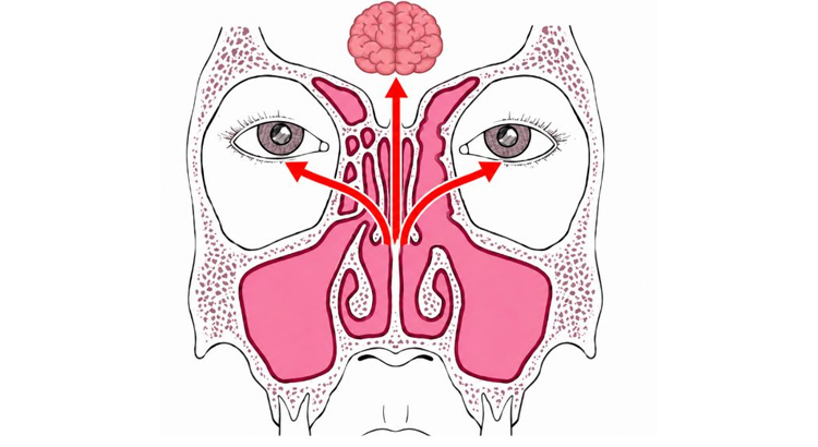 Endoscopic Sinus & Skull Base Surgery