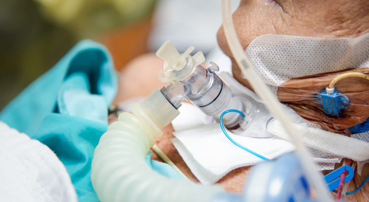Tracheostomy